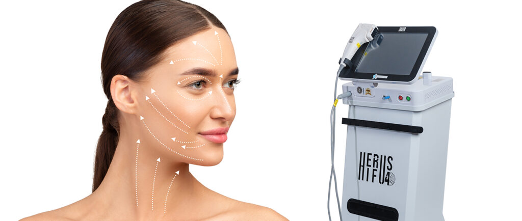 Herus HIFU: lifting facial não cirúrgico e tratamento de flacidez com ultrassom microfocado